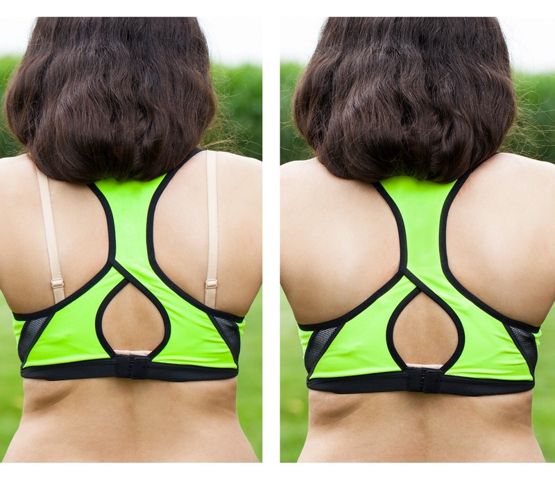 Bra Strap Clips Back Anti-Slip Bra Straps Holder Buckles Cleavage Control 3pk gallery